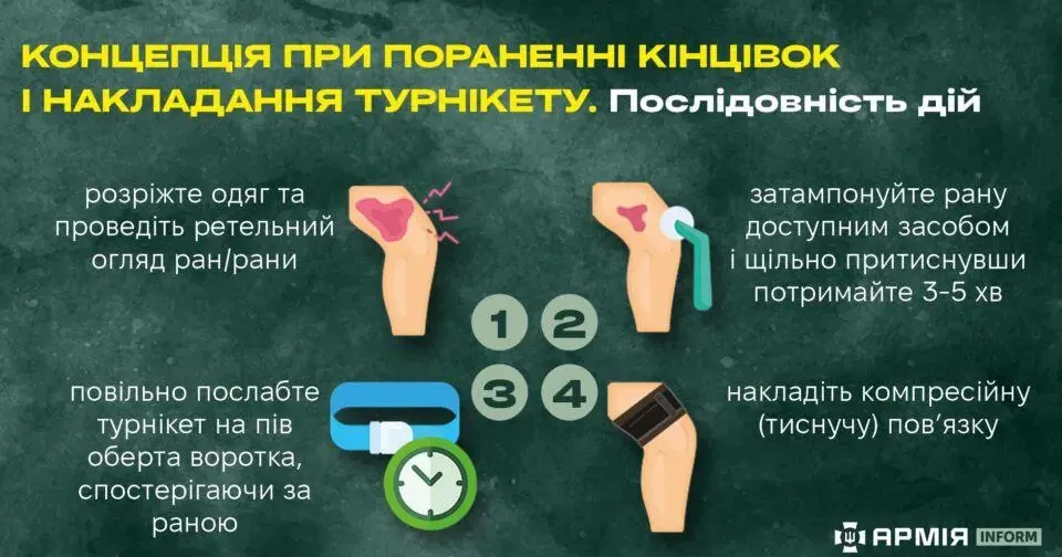 Інфографіка Сергія Поліщука / АрміяInform Поради бойового медика: як врятувати кінцівку на порталі Gromada Group
